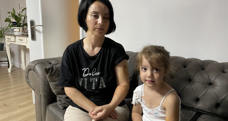 Samsun’da iki köpeğin saldırısına uğrayan anne ile kızı yaralandı
